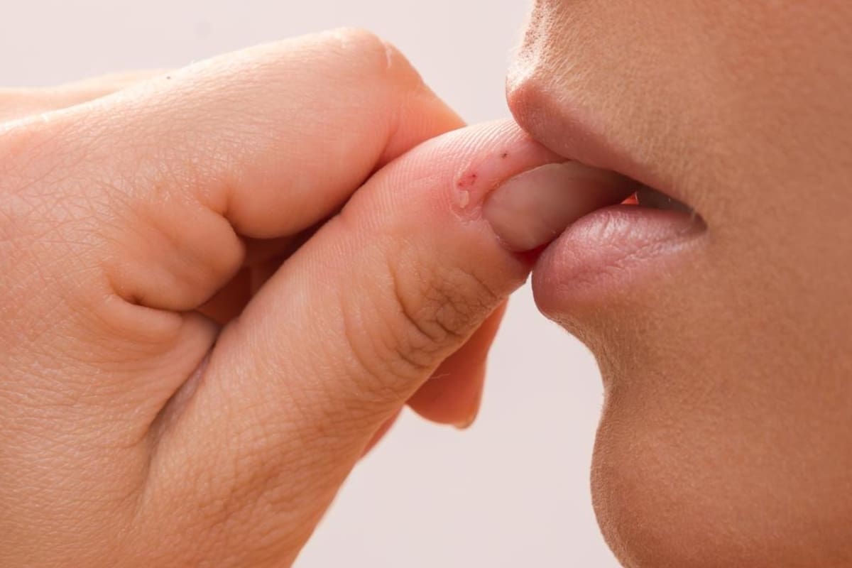 Morderse las uñas puede ocurrir en situaciones de ansiedad o inactividad