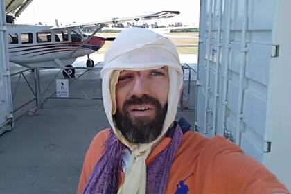 Morgan Segui sufrió un accidente que podría haberle costado la vida, pero lo salvó un rebaño de cabras (foto: Les Others)