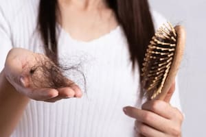 Muchas personas sufren la caída del pelo