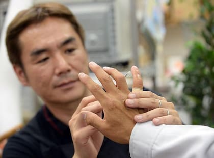 Muchos exmiembros de la yakuza que se practicaron el yubitsume se reconstruyen el meñique con prótesis para reinsertarse en la sociedad japonesa, donde un dedo cortado implica un fuerte estigma.