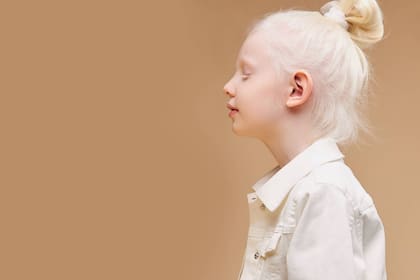 Mujeres, niños y personas con condicionantes de salud, como los albinos, son el perfil predominante entre las personas atacadas por brujería en estos tiempos, según la ONU