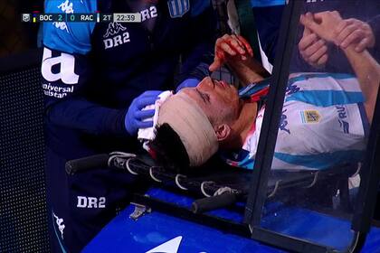 Mura es retirado con una venda en su cabeza y rastros de sangre tras el golpe de Villa