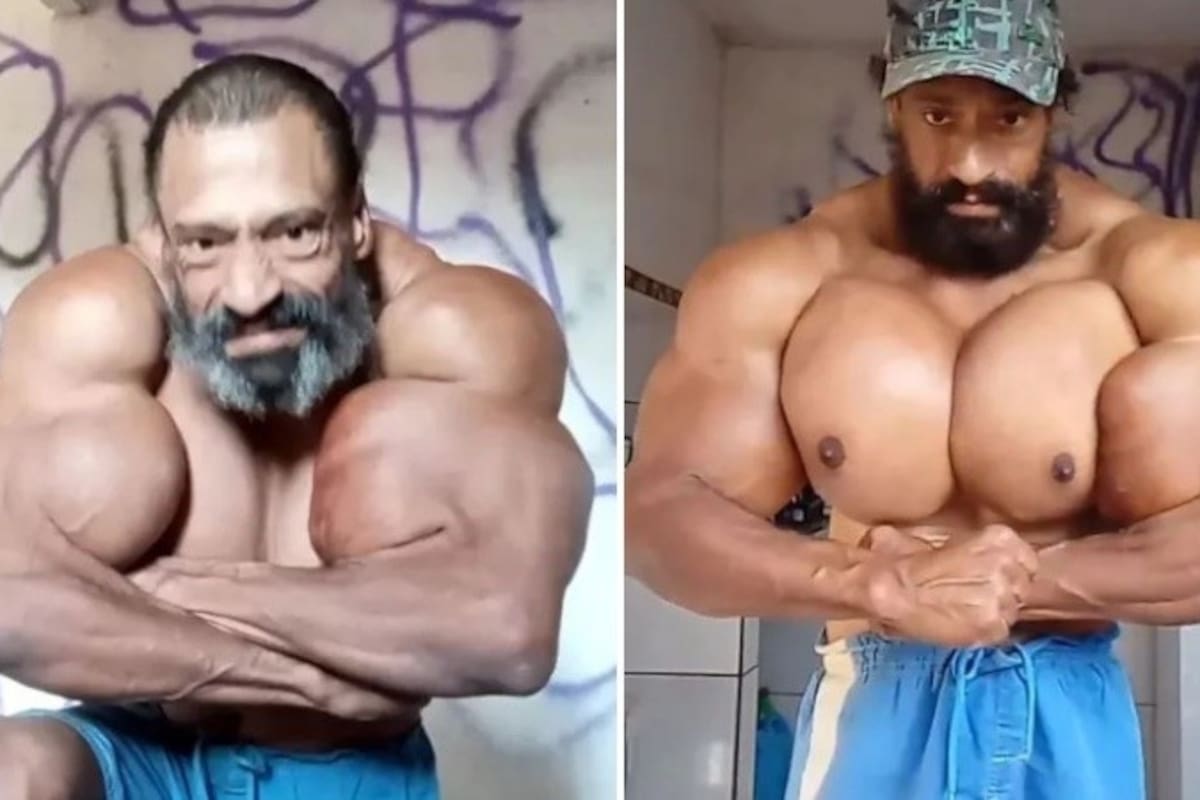 Murió el “Hulk brasileño”, un famoso fisicoculturista que se había inyectado aceite en sus músculos.