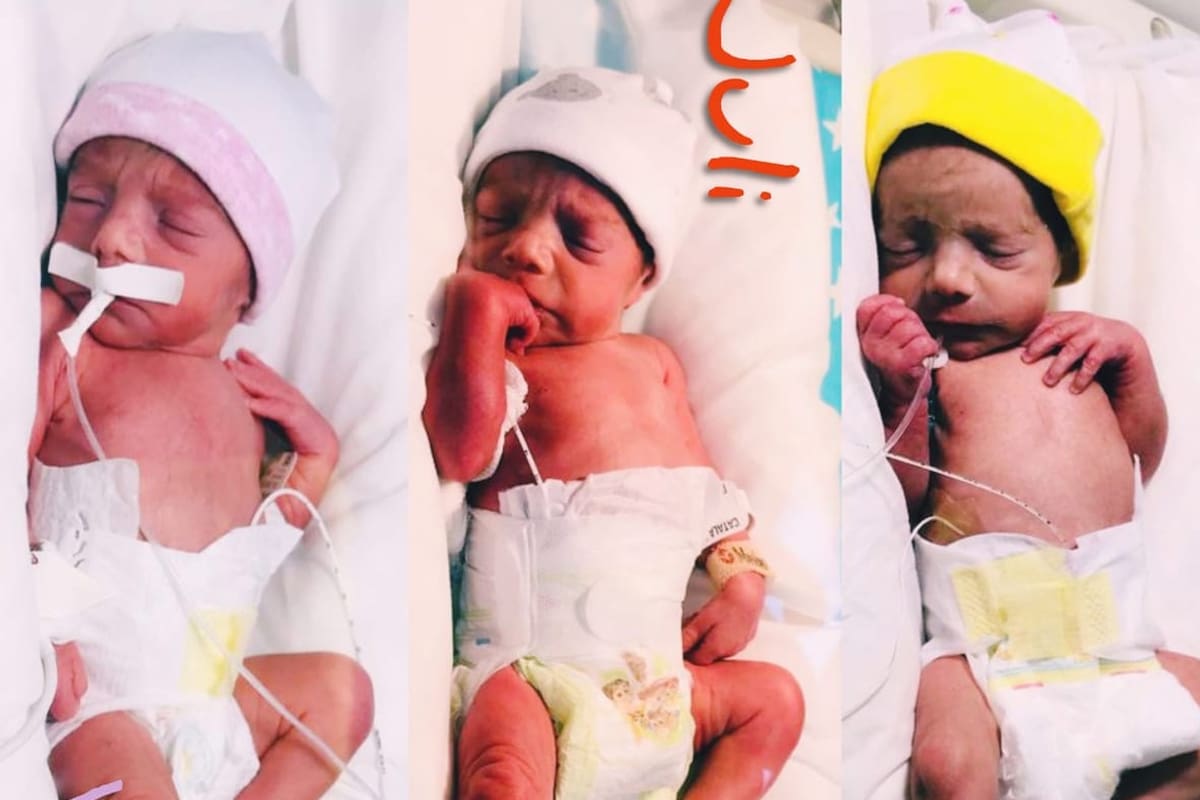 Nacieron trigemelas en Lomas de Zamora