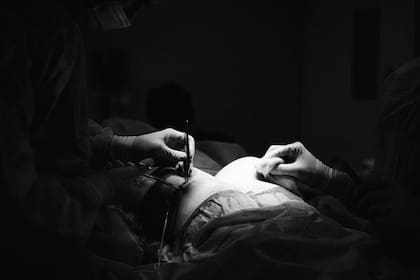 Nanci sufrió una reacción adversa a la anestesia y clínicamente falleció en la mesa de operaciones (Imagen ilustrativa)