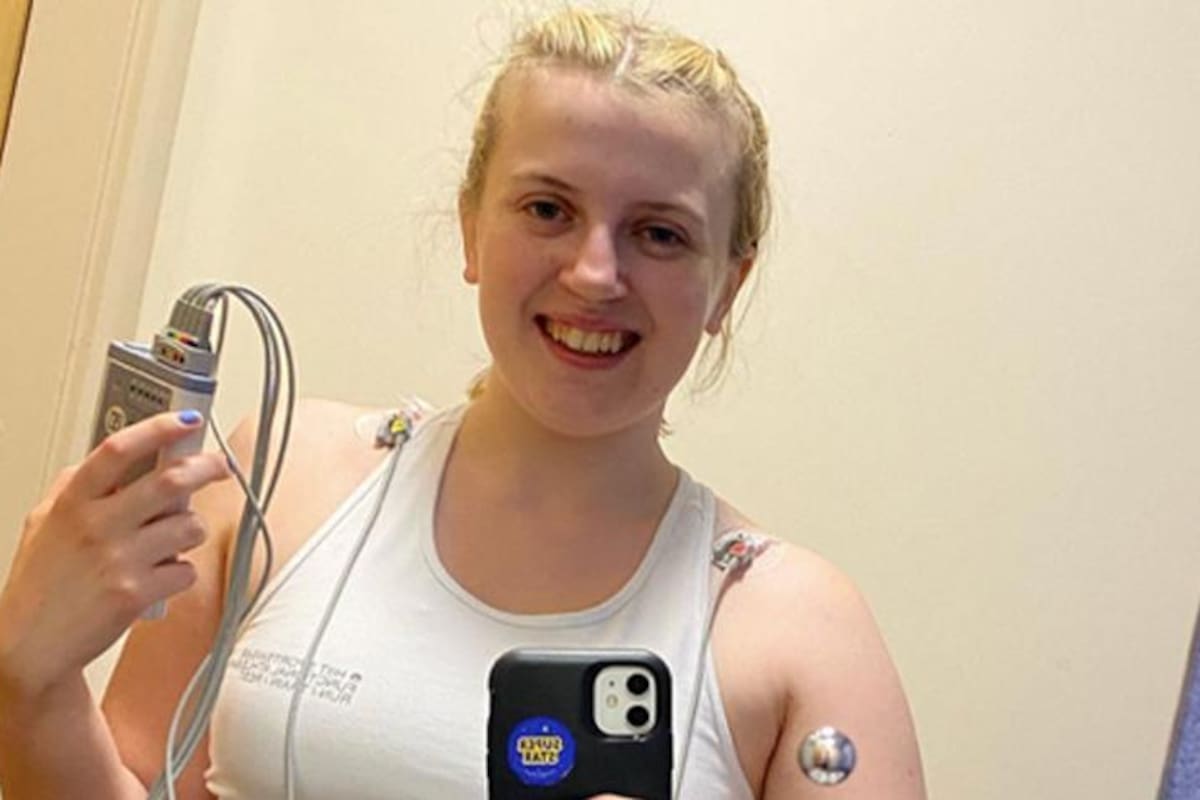 Natasha Coates tuvo desde pequeña reacciones extrañas