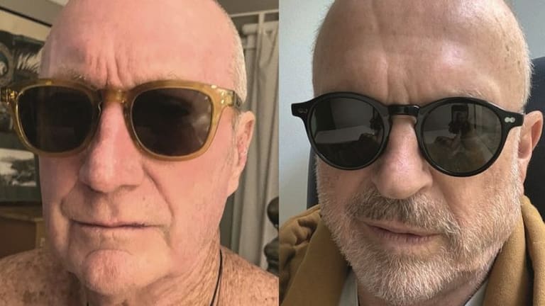 Neill contó, luego de conocerse su diagnóstico, que una de las cosas que más lamentaba era la pérdida de cabello