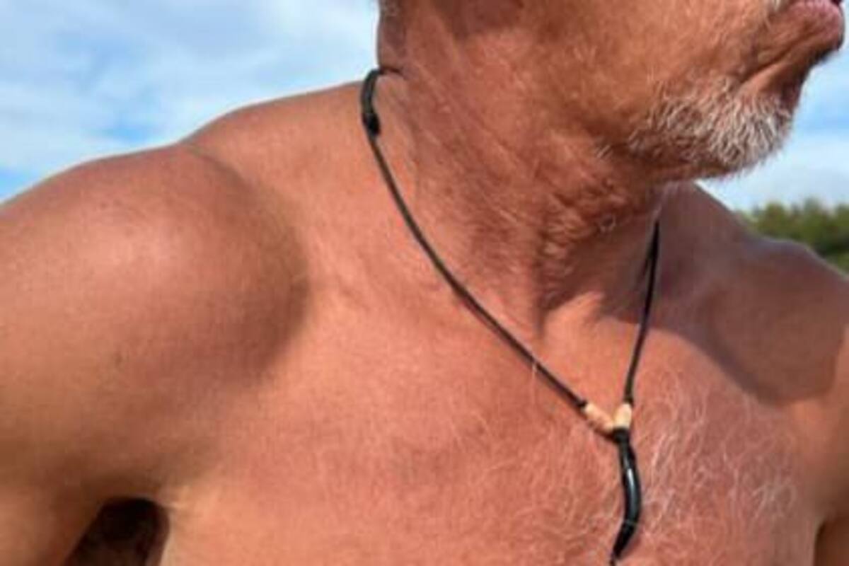 Néstor fue mordido por un vendedor de jugos. La historia se viralizó en las redes sociales