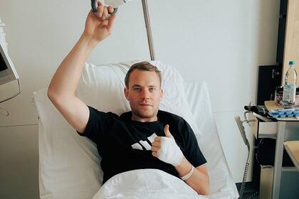 Neuer se fracturó una pierna esquiando