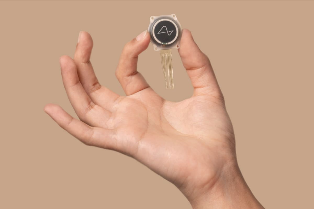 Neuralink dice que probó con éxito en un segundo voluntario su chip, que se inserta en el cerebro y permite controlar una computadora con la mente