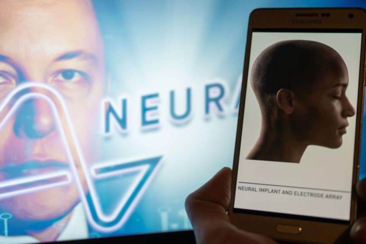 Neuralink es una compañía de neurotecnología especializada en el desarrollo de interfaces cerebro-computador.