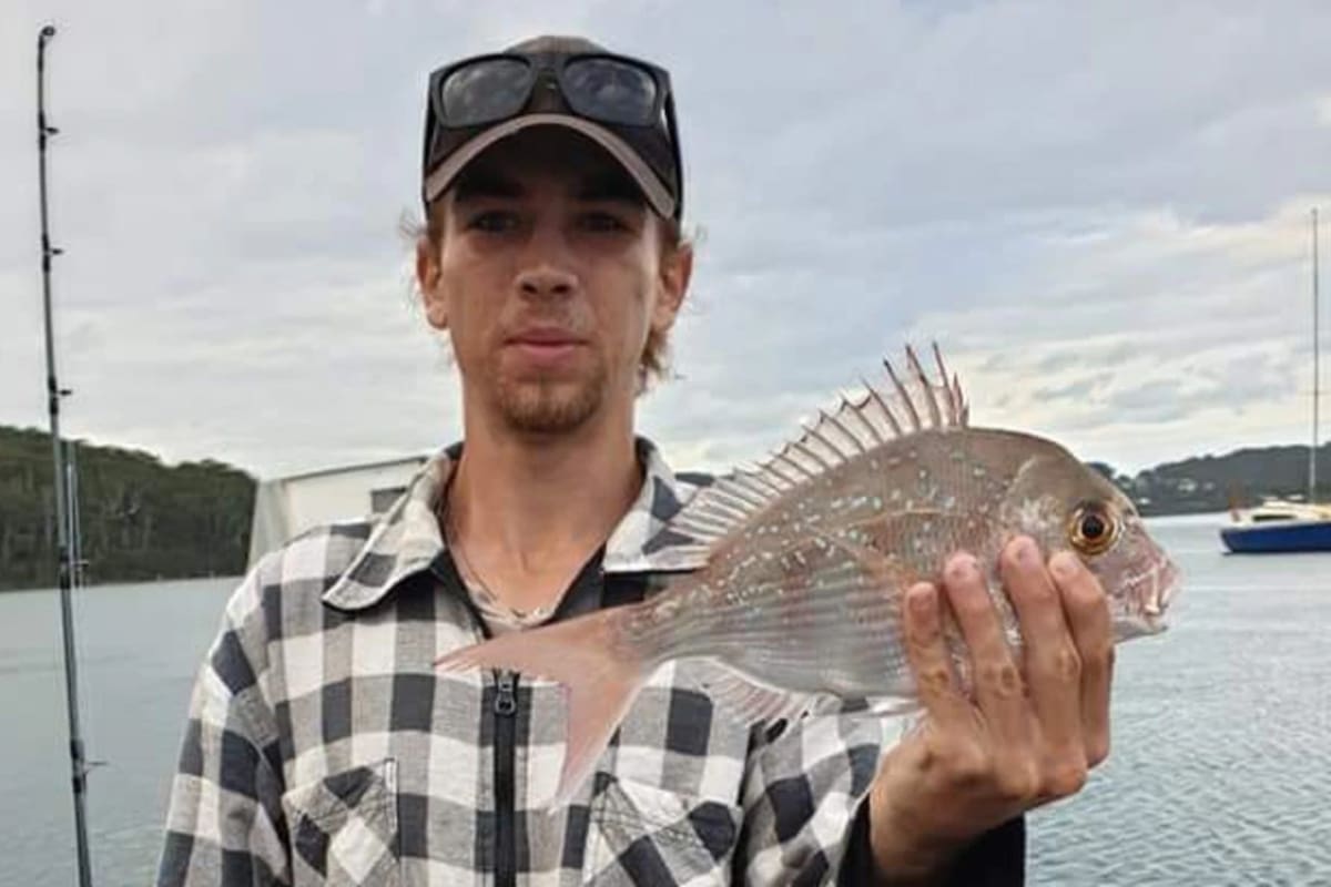 Nick Myhill tiene 18 años y recibió un fuerte golpe en la cabeza luego de que una ballena impactara contra la lancha en la que se encontraba a bordo