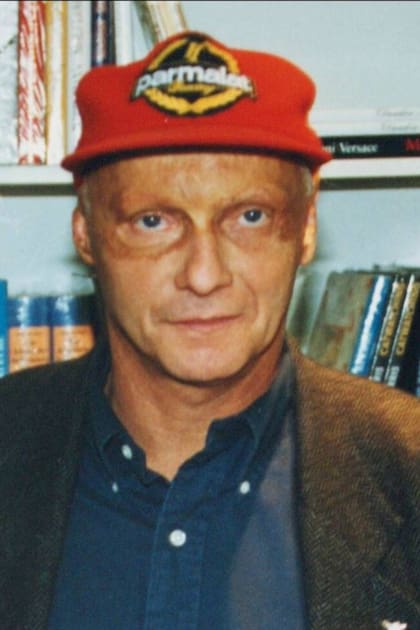 Niki Lauda nunca se preocupó por el aspecto que fue consecuencia de su accidente