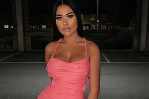 Nikita es una joven que quiso tener el trasero de Kim Kardashian pero cuatro años después descubrió que era una pesadilla