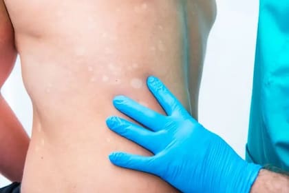 No hay una gran comprensión de la enfermedad dentro de la comunidad médica