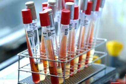 No todas las personas en riesgo de haberse contagiado tienen acceso a las pruebas para coronavirus en EE.UU.