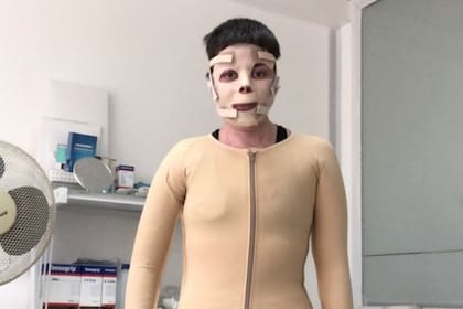 Noelia tuvo que aprender a caminar de nuevo