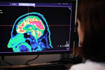 Nuestro cerebro está configurado para sobrevivir a las situaciones extremas, pero su respuesta varía en función de diversos factores. Crédito: BBC Mundo