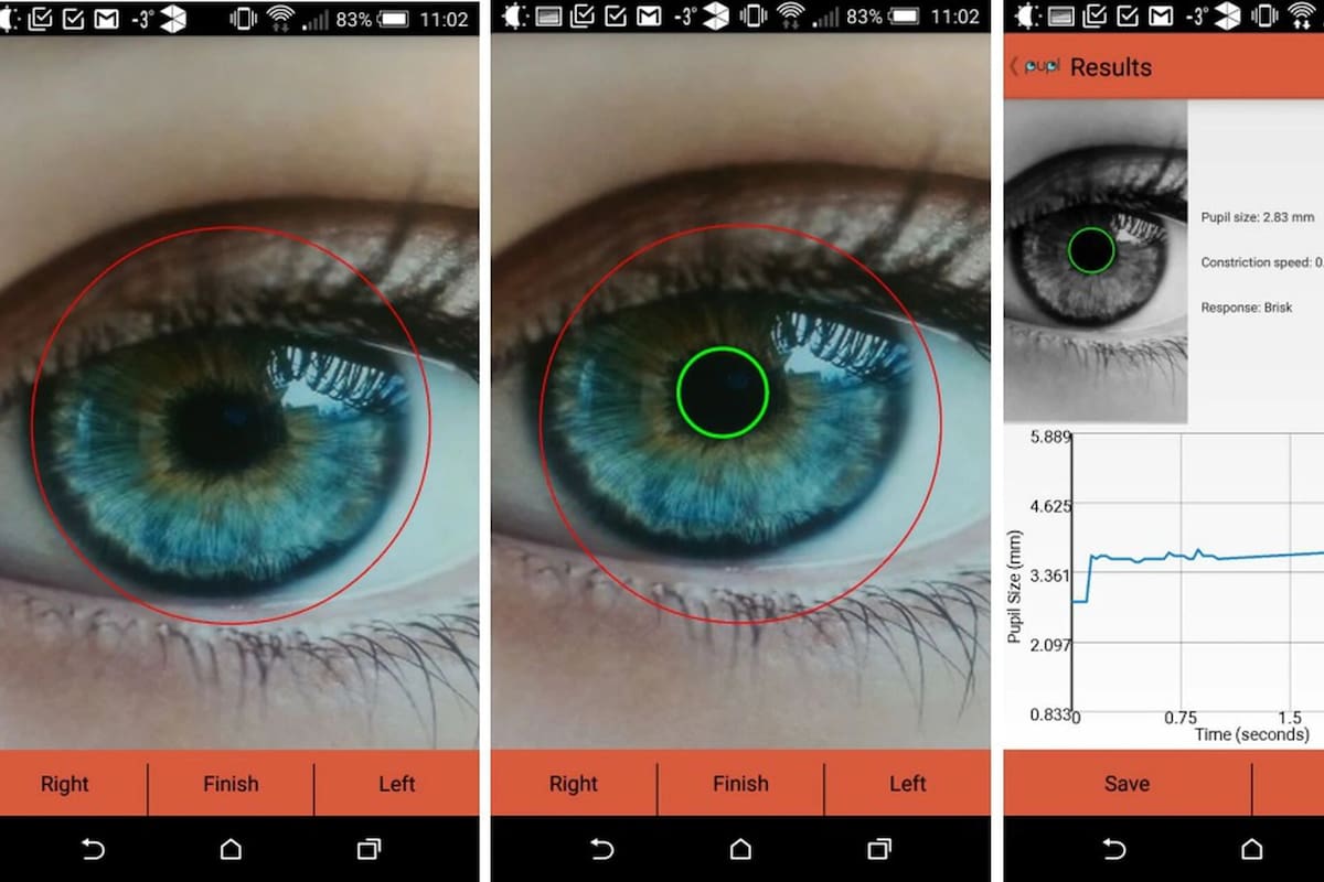 nvestigadores de la Universidad de California en San Diego han desarrollado una aplicación para teléfonos inteligentes para identificar, mediante primeros planos de los ojos, signos de alzhéimer, trastorno por déficit de atención e hiperactividad (TDAH) y otros trastornos neurológicos.