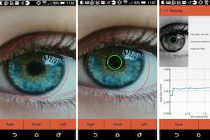 nvestigadores de la Universidad de California en San Diego han desarrollado una aplicación para teléfonos inteligentes para identificar, mediante primeros planos de los ojos, signos de alzhéimer, trastorno por déficit de atención e hiperactividad (TDAH) y otros trastornos neurológicos.
