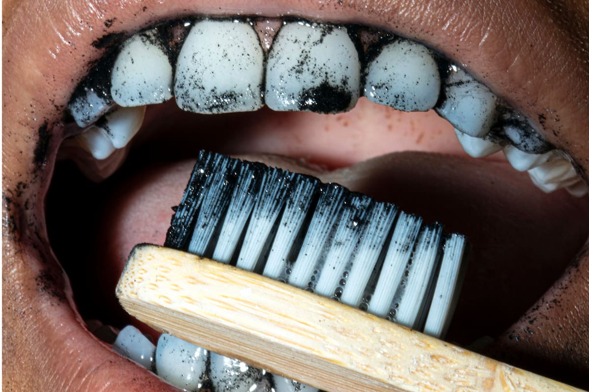 NYT; Cuidado dental; Sociedad;