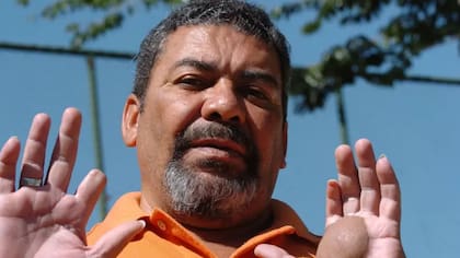 Odesson Ferreira perdió parte de sus dedos a causa de la radiación.