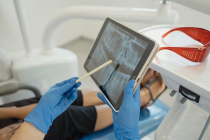 Odontólogos advierten sobre casos de caries asociados al consumo de bebidas alcohólicas