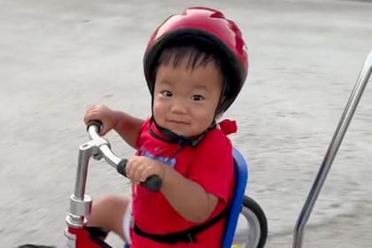 Oliver Chu padece una rara enfermedad hereditaria llamada síndrome de Hunter (MPSII)