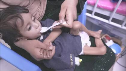 Omid tiene 14 meses pero pesa lo mismo que un recién nacido