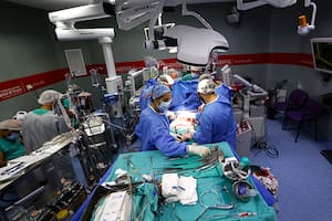 Operación de una tromboendartectomía, a cargo del cirujano Marcelo Nahim, en el hospital El Cruce, Nestor Kirchner de Florencio Varela