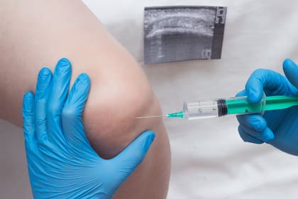 Ozonoterapia