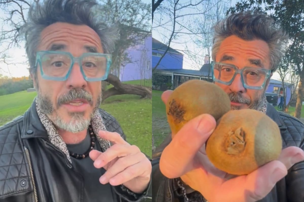 Pablo Granados compartió con sus seguidores de Instagram su experiencia haciéndose la vasectomía y buscó generar consciencia sobre la intervención (Foto: Captura Instagram @pablo_grana)