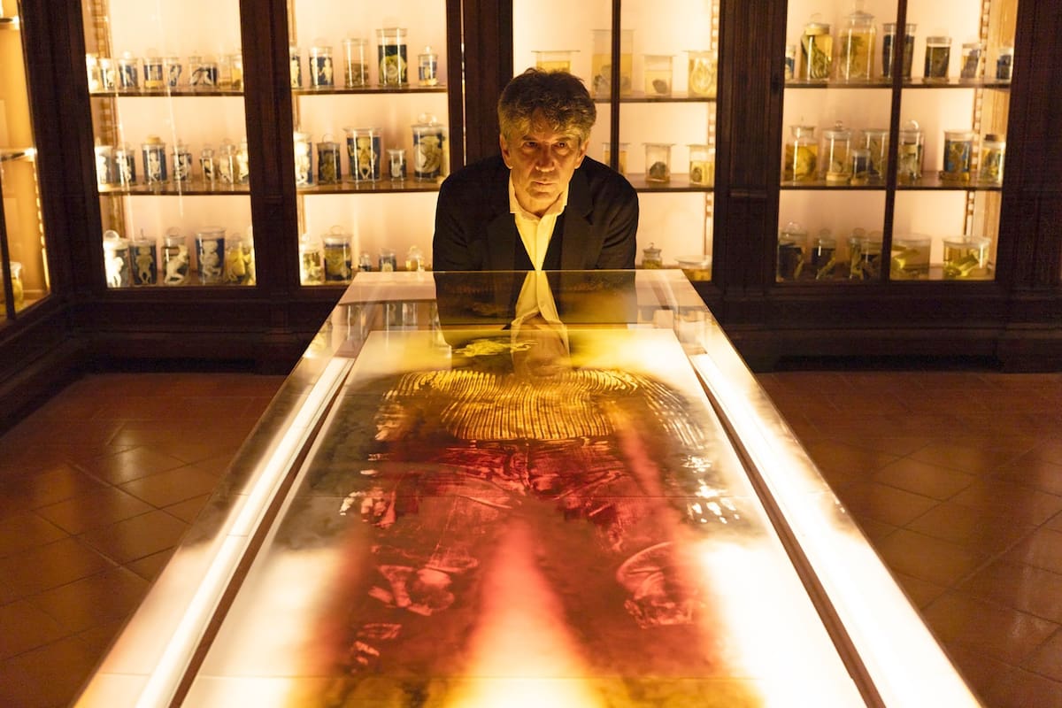 Pablo La Padula con su autorretrato que donó al museo de anatomía de Nápoles