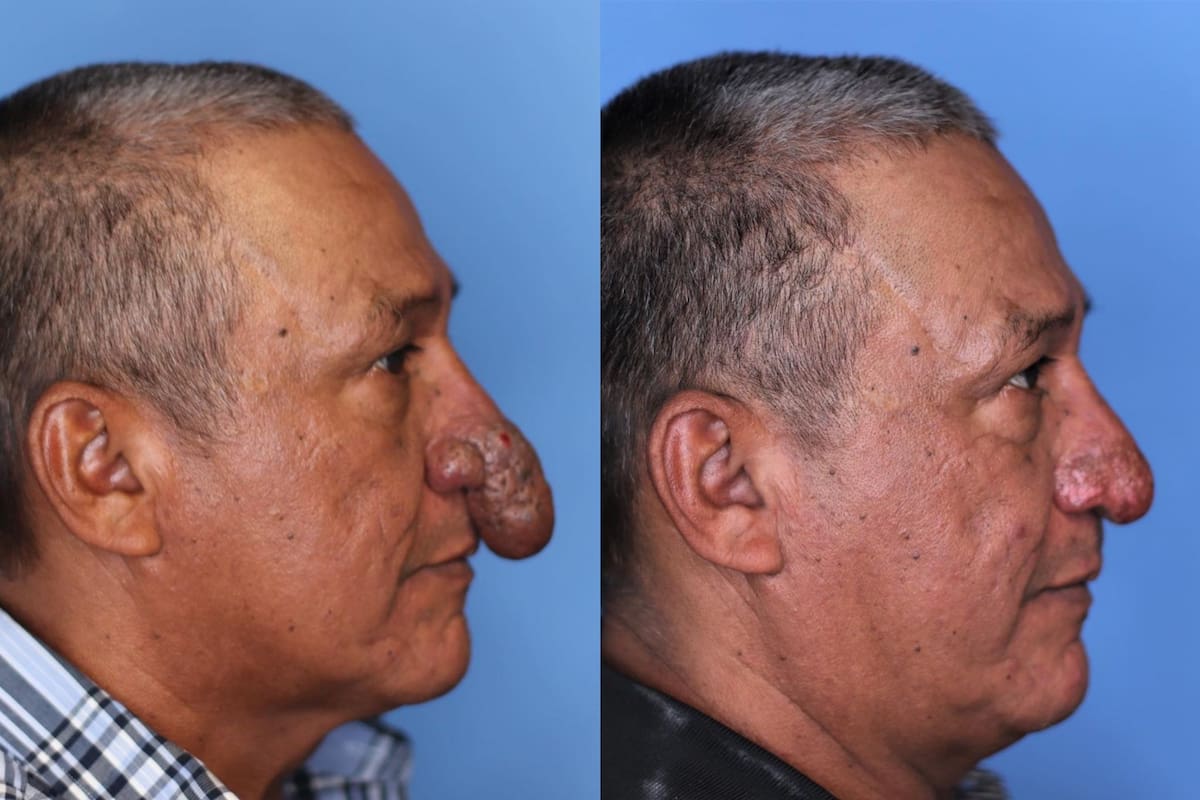 Padecía una rara enfermedad y el cirujano plástico al que le pintó la casa decidió ayudarlo