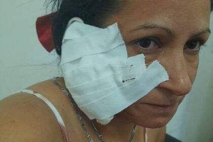 Pamela San Martín sufrió una seria lesión en una de sus orejas