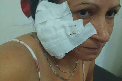 Pamela San Martín sufrió una seria lesión en una de sus orejas