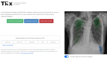 Pantalla con el resultado de la aplicación TRX: hallazgos sugeridos del análisis por IA de una imagen de tórax