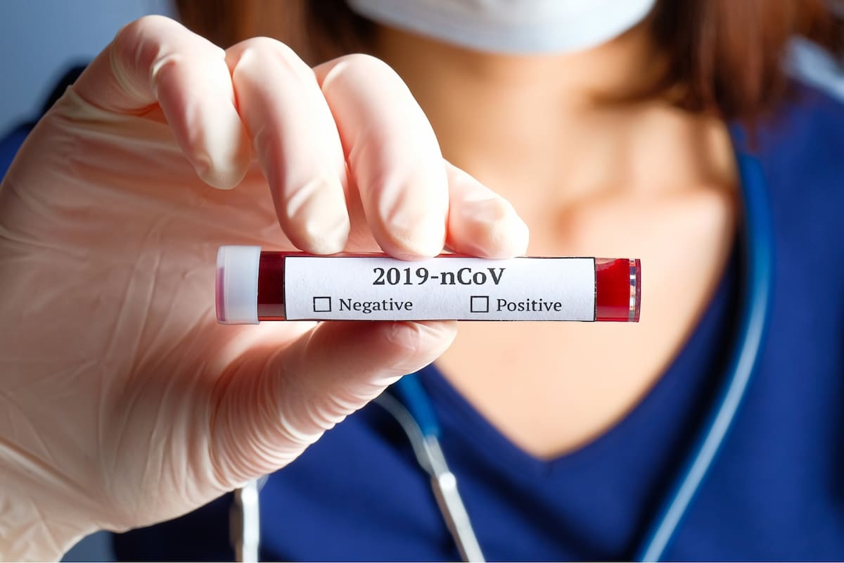 Para comprender y contener el brote sin precedentes del SARS-CoV-2 se necesitan modelos de predicción de datos que requerirán la colaboración entre epidemiólogos y matemáticos. Además, los datos deberían intercambiarse de manera libre entre científicos y sanitarios en todo el mundo, según argumenta