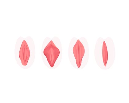 Monica fue diagnosticada con cáncer de vulva