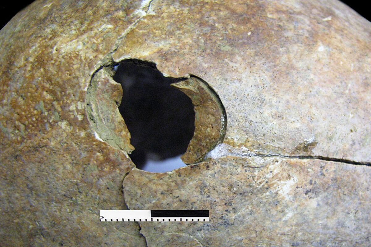 “Para la mayoría de la gente, un golpe fue suficiente”, dijo el arqueólogo Mario Novak, responsable del descubrimiento