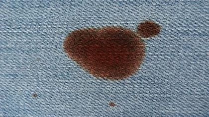 Para retirar manchas de sangre se recomienza utilizar agua oxigenada