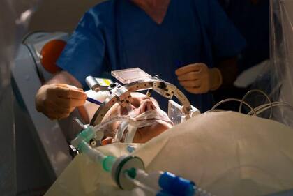 Para tratar el mal de Parkinson, se inactivan ciertas neuronas con estimulación profunda del cerebro.