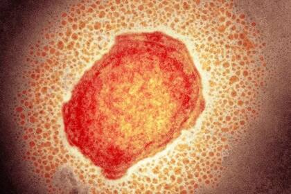 Partícula del virus de la viruela del mono