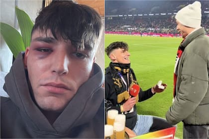 Pascal Kaiser, árbitro alemán, sufrió una brutal golpiza tras la propuesta de matrimonio a su novio