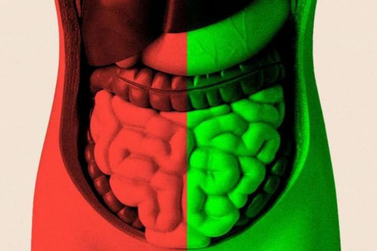 Pasé meses tratando de averiguar si mejorar mi salud intestinal podría ayudarme a envejecer mejor.
