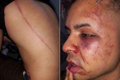 Patovicas atacaron a latigazos a una pareja en la puerta de un boliche en San Miguel de Tucumán