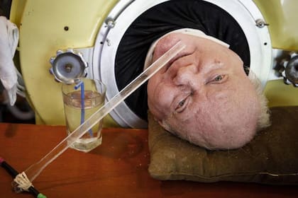 Paul Alexander, conocido como "Polio Paul", pasó las últimas siete décadas conectado a un artefacto que solía usarse antes del desarrollo de la vacuna contra la poliomielitis. Fuente: AP