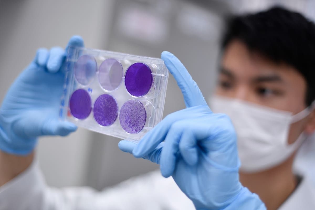 Pekín tiene cuatro vacunas de Covid-19 en la fase final de los ensayos clínicos