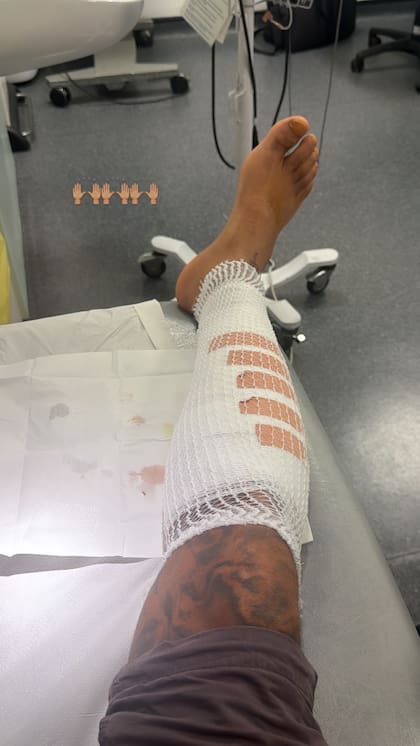 Pennant deberá cuidar de su pierna para no sufrir una infección