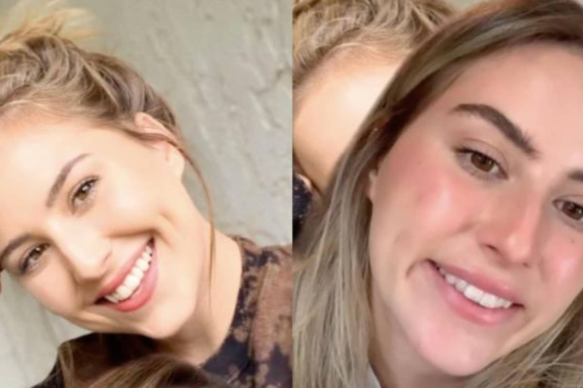 Perdió la sonrisa por una inyección de bótox.